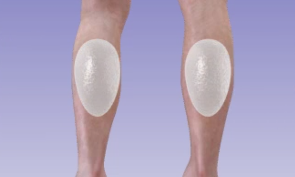 ایمپلنت ساق پا