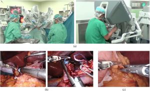 رباتیک در جراحی